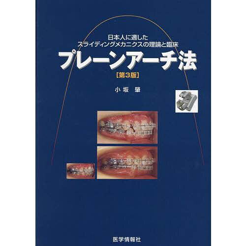 プレーンアーチ法 日本人に適したスライディングメカニクスの理論と臨床