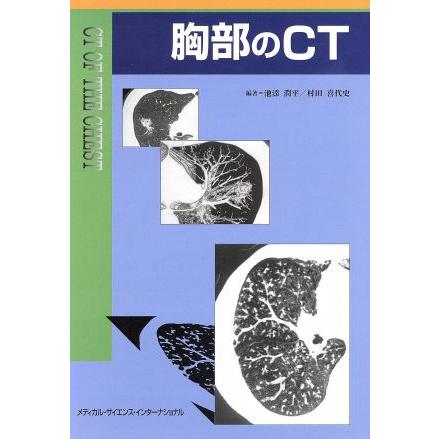 胸部のＣＴ／村田喜代史(著者)