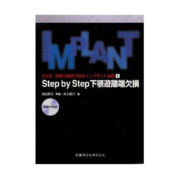 Step by 下顎遊離端欠損