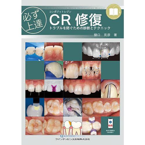 必ず上達 CR 修復 トラブルを防ぐための診断とテクニック