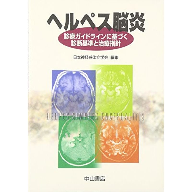 ヘルペス脳炎?診療ガイドラインに基づく診断基準と治療指針