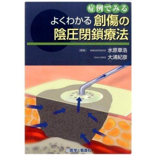 症例でみるよくわかる創傷の陰圧閉鎖療法