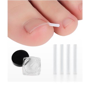 (杰恆)預購los1017D正甲器嵌甲填充墊甲溝腳趾甲長肉裏填充條正甲墊貼絲矯正