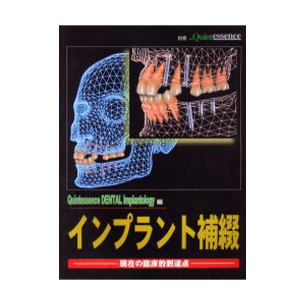 インプラント補綴 現在の臨床的到達点