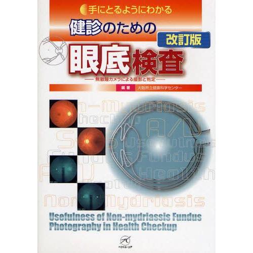 手にとるようにわかる健診のための眼底検査 : 無散瞳カメラによる撮影と判定 手にとるようにわかる健診のための眼底検査 無散瞳カメラによる