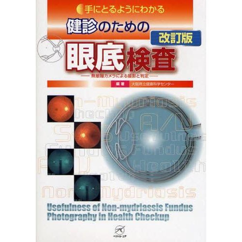 手にとるようにわかる健診のための眼底検査 無散瞳カメラによる撮影と判定 | LINEブランドカタログ