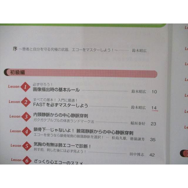 US82-284 羊土社 あてて見るだけ! 劇的! 救急エコー塾 13m3C