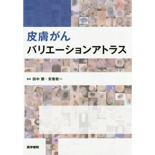 皮膚がんバリエーションアトラス