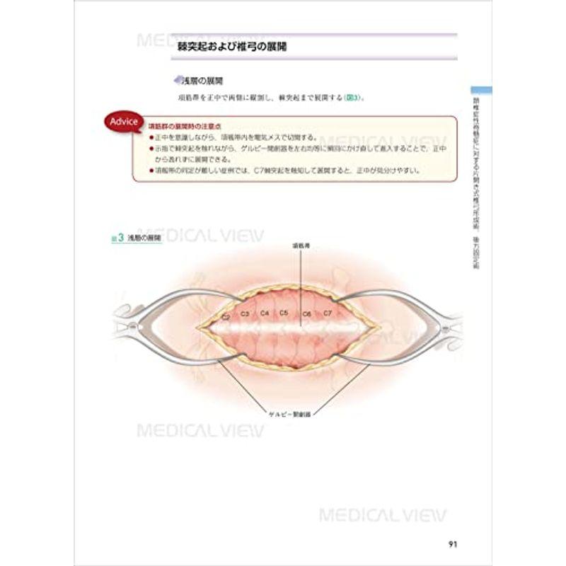 脊椎 (新 執刀医のためのサージカルテクニック)