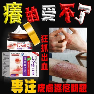 止癢膏止癢膏止癢,硬皮炎、皮疹膏止癢、皮疹膏止癢、長疙瘩固型硬疙瘩、皮炎丘疹濕疹紅腫留疤7.4