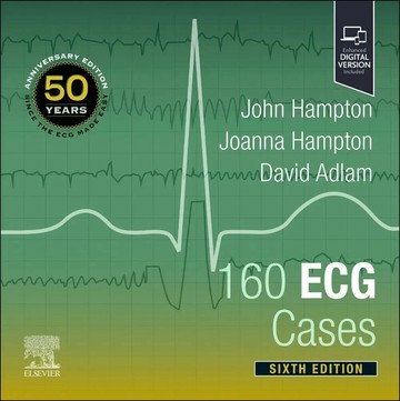 160 ECG Cases 6/e Hampton 2025 Elsevier