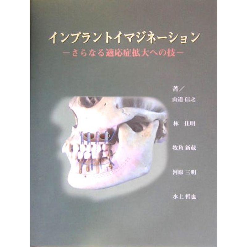 インプラントイマジネーション?さらなる適応症拡大への技