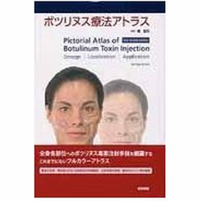 ボツリヌス療法アトラス www.expressinter.com