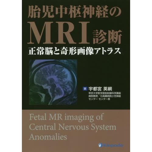 胎児中枢神経のMRI診断 正常脳と奇形画像アトラス