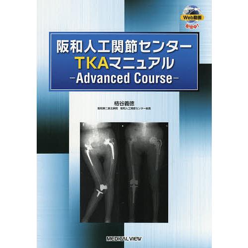 阪和人工関節センターTKAマニュアル Advanced Course