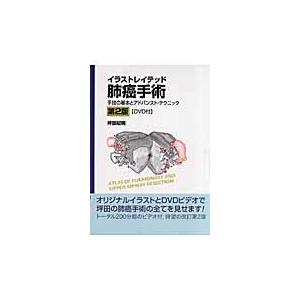 翌日発送・イラストレイテッド肺癌手術 第２版 坪田紀明