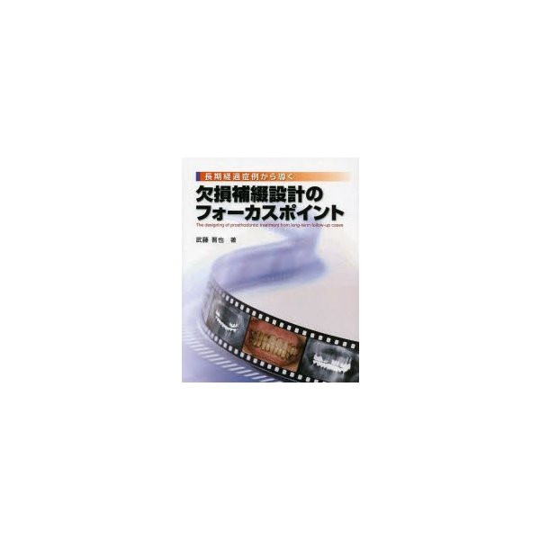 長期経過症例から導く欠損補綴設計のフォーカスポイント