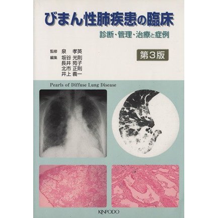 びまん性肺疾患の臨床　第３版　診断・管理／泉孝英(著者)