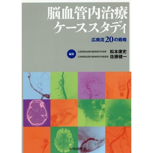 脳血管内治療ケーススタディ 広南流20の戦略