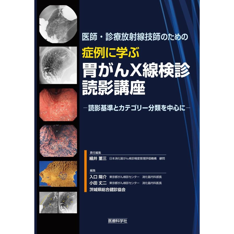 医師・診療放射線技師のための 症例に学ぶ胃がんX線検診読影講座 読影基準とカテゴリー分類を中心に