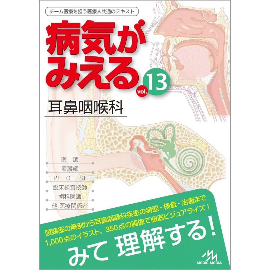 病気がみえるvol.13 耳鼻咽喉科