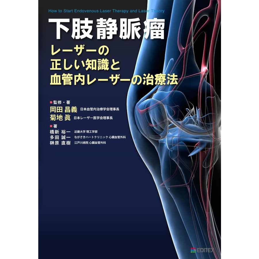 下肢静脈瘤 レーザーの正しい知識と血管内レーザーの治療法