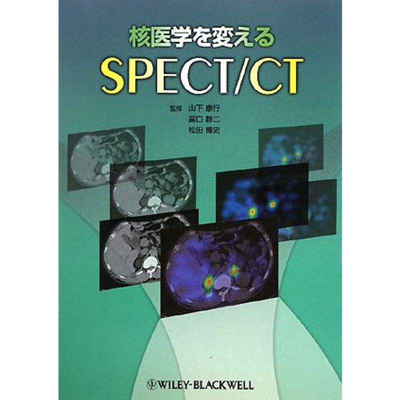 核医学を変えるSPECT CT