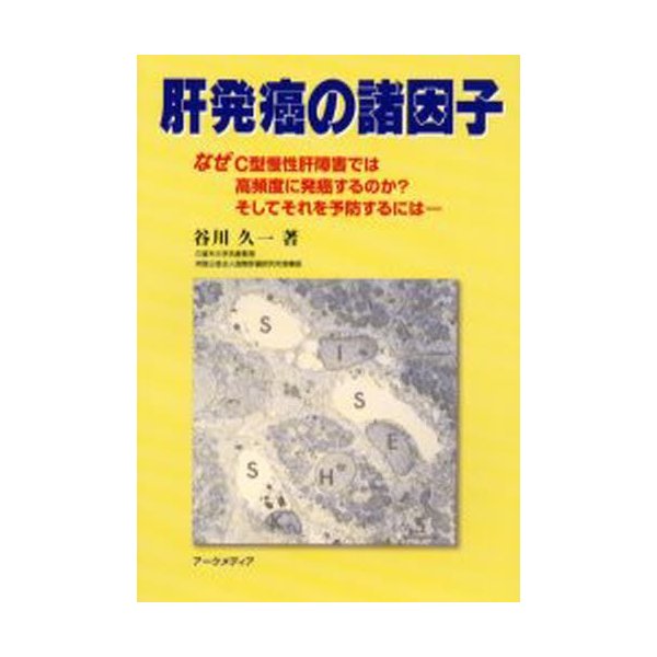 肝発癌の諸因子 なぜC型慢性肝障害では高頻度に発癌するのか そしてそれを予防するには- 谷川久一