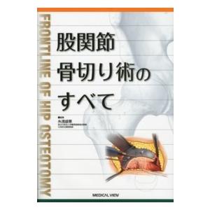 股関節骨切り術のすべて