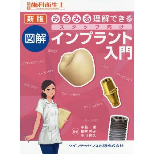 新版 みるみる理解できる 図解 スタッフ向けインプラント入門