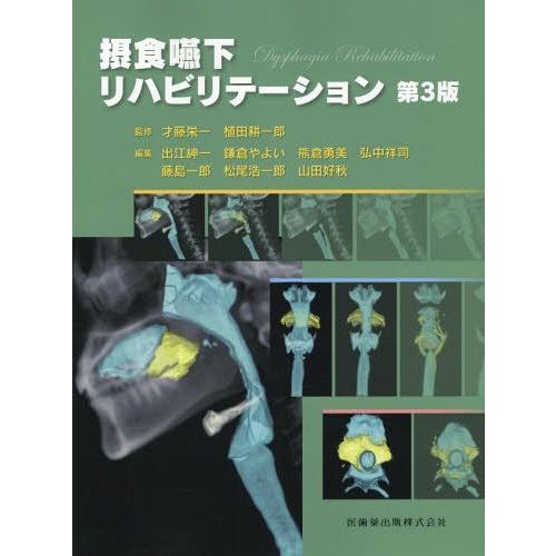 摂食嚥下リハビリテーション