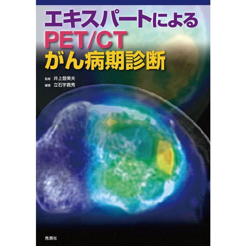 エキスパートによるPET CTがん病期診断