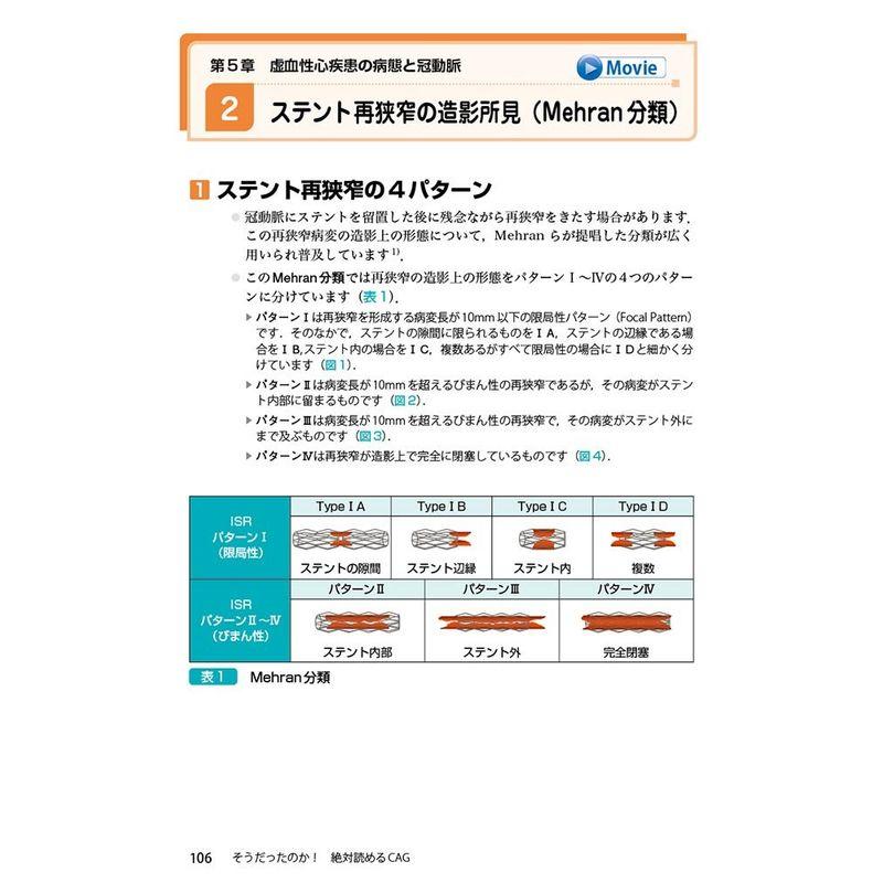 そうだったのか 絶対読めるCAG~シェーマでわかる冠動脈造影の読み方