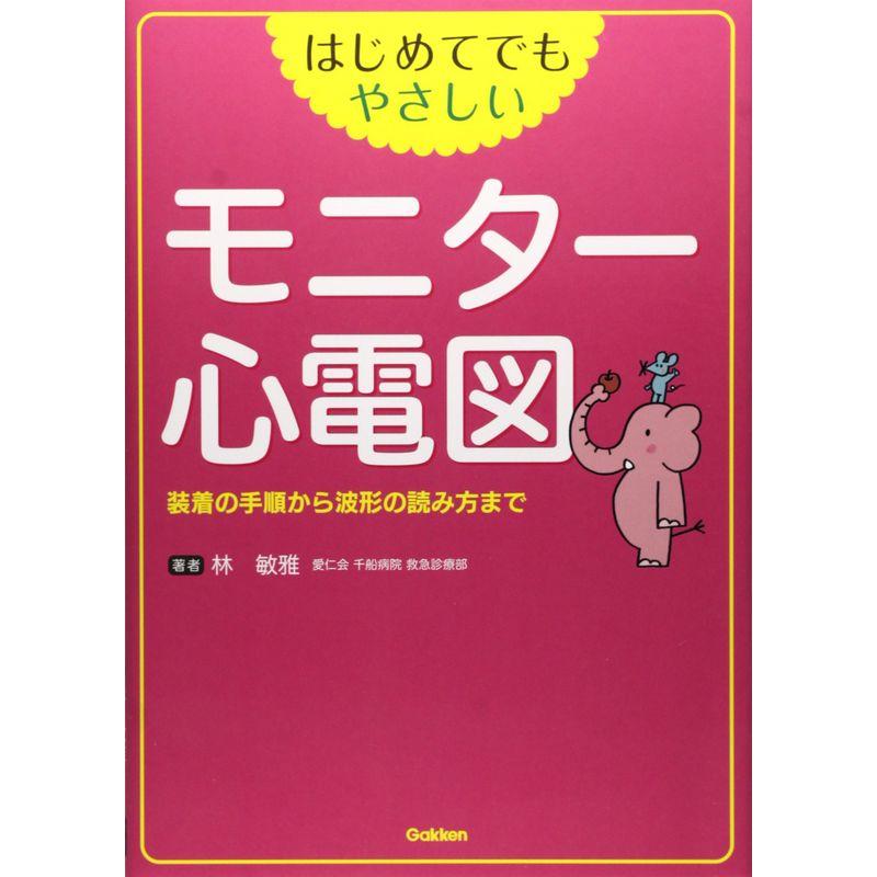 はじめてでもやさしい モニター心電図: 装着の手順から波形の読み方まで