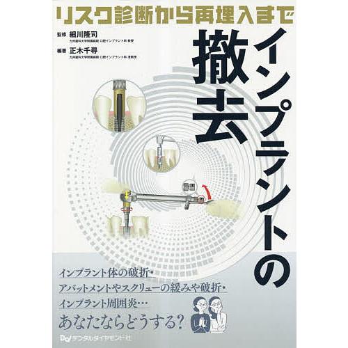 インプラントの撤去 リスク診断から再埋入まで