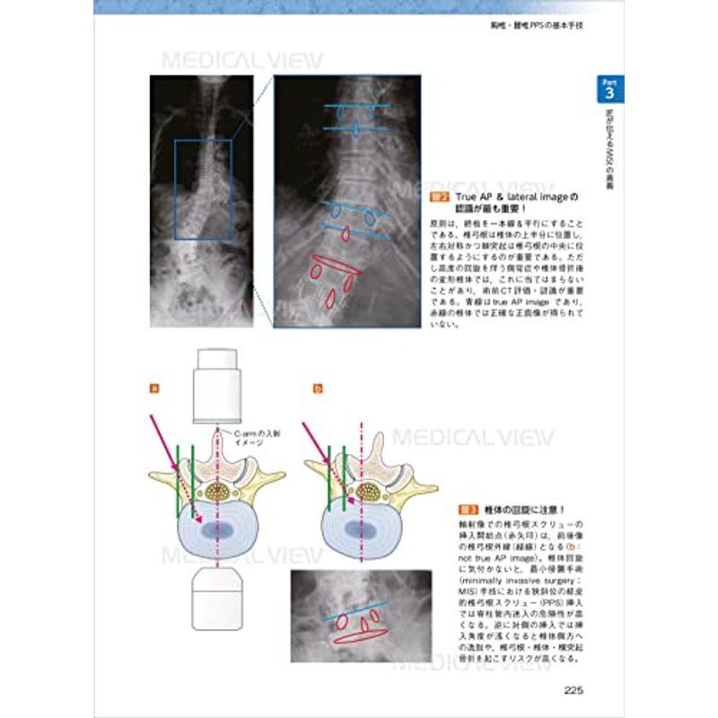 匠が伝える低侵襲脊椎外科の奥義