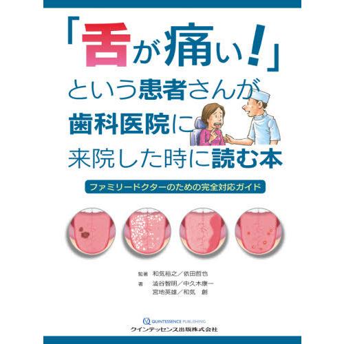 舌が痛い という患者さんが歯科医院に来院した時に読む本