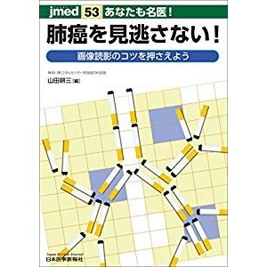 あなたも名医! 肺癌を見逃さない!  画像読影のコツを押さえよう (jmed 53)