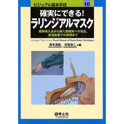 確実にできる ラリンジアルマスク 標準挿入法から挿入困難例への対応,救急医療での使用まで 岡本浩嗣 村島浩二