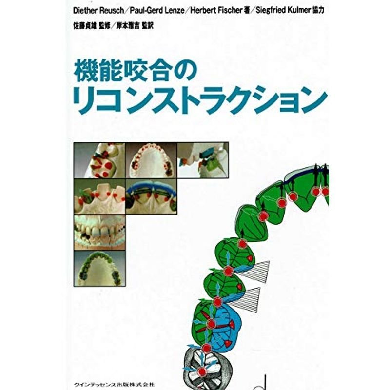 機能咬合のリコンストラクション