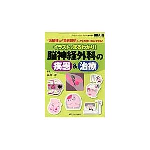 イラストでまるわかり 脳神経外科の疾患 治療 お勉強 と 患者説明 ,2つの使い方ができる