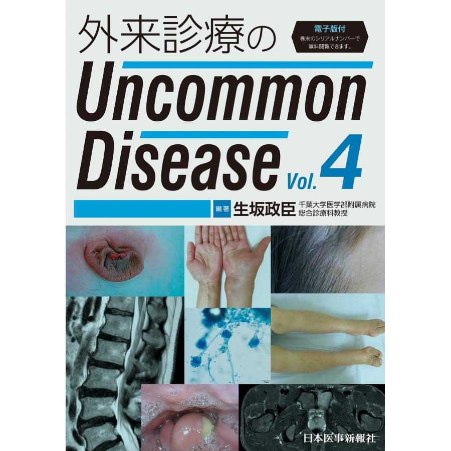 外来診療のUncommon Disease Vol.4