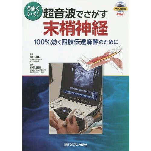 うまくいく 超音波でさがす末梢神経 100%効く四肢伝達麻酔のために