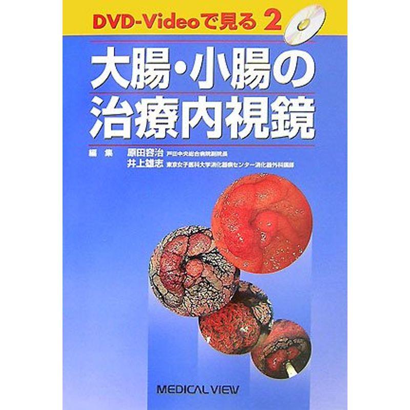 大腸・小腸の治療内視鏡 (DVD-Videoで見る治療内視鏡 2)
