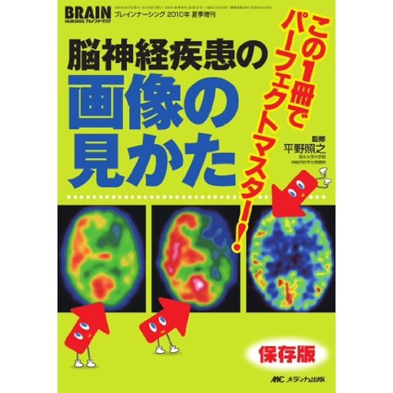 この1冊でパーフェクトマスター 脳神経疾患の画像の見かた (ブレインナーシング2010年夏季増刊)