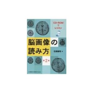 CD-ROMでレッスン 脳画像の読み方 第2版