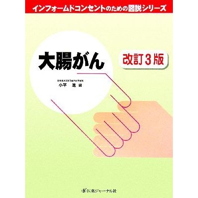 大腸がん インフォームドコンセントのための図説シリーズ／小平進