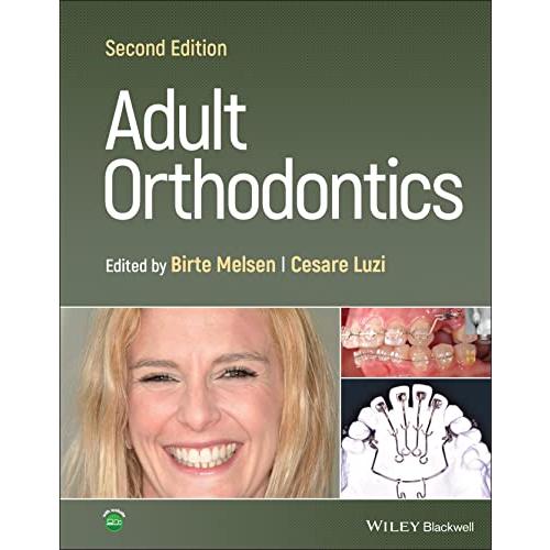 Adult Orthodontics