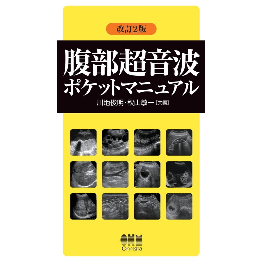 腹部超音波ポケットマニュアル (改訂2版) 電子書籍版   編:川地俊明 編:秋山敏一