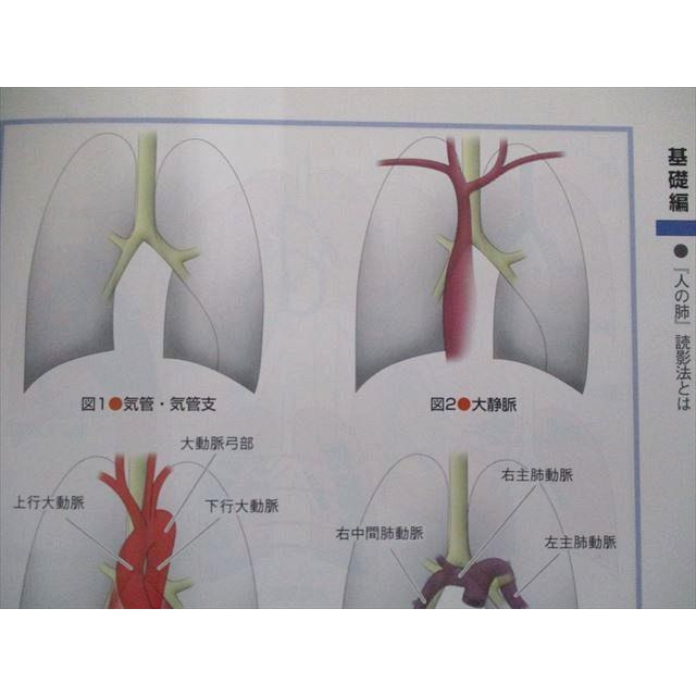 UW81-283 羊土社 見逃しなく読める!胸部X線画像診断QA―「人の肺」読影法と症例演習 11m3C